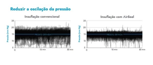 AirSeal IFS - A Insuflação Reinventada - Image 3